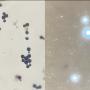 Left: Gram stain showing round yeast cells with budding; Right: India ink preparation positive for encapsulated yeasts