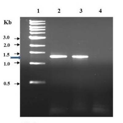 Figure 1: Analysis of PfNT3 PCR products on 0.8% agarose gel electrophoresis. Lane 1-Molecular marker lane; Lane 2 & 3-1.3Kb PCR product; Lane 4-negative control