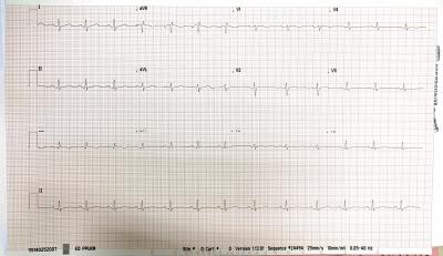 Patient’s ECG on arrival showed sinus tachycardia